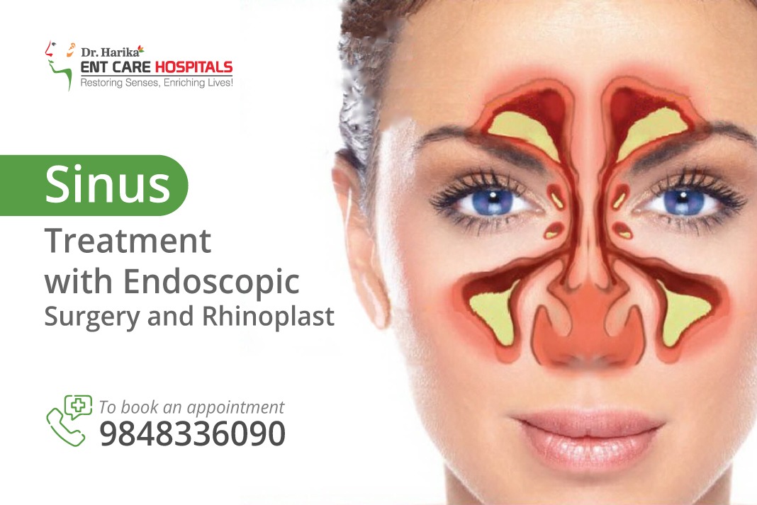 Chronic Sinusitis Symptoms and its Treatment