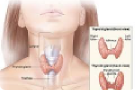 thyroidectomy surgery